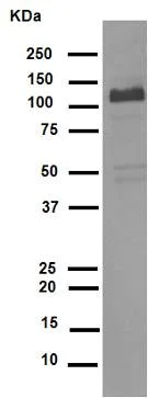 Western blot - Anti-Collagen I antibody [EPR7785] (AB138492)
