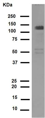 Western blot - Anti-Collagen I antibody [EPR7785] (AB138492)