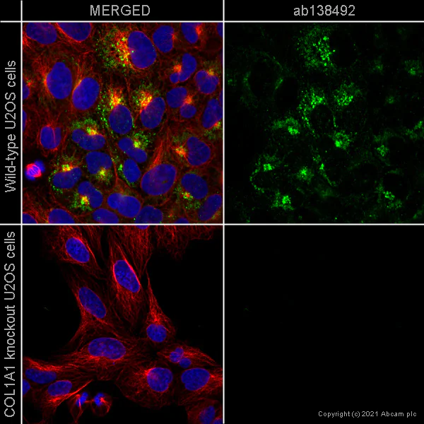 おまとめ【aph30】【aph35】【cal67】【fl267】 Anti-SC35 antibody [EPR12238] Rabbit monoclonal (ab204916