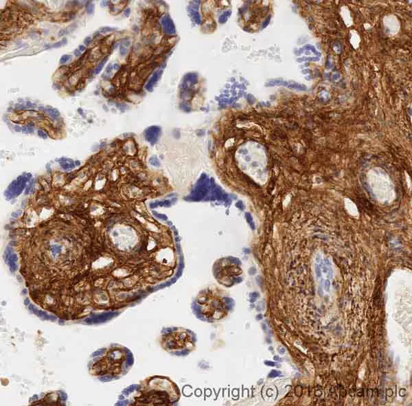 Immunohistochemistry (Formalin/PFA-fixed paraffin-embedded sections) - Anti-Collagen I antibody [EPR7785] - BSA and Azide free (AB215969)