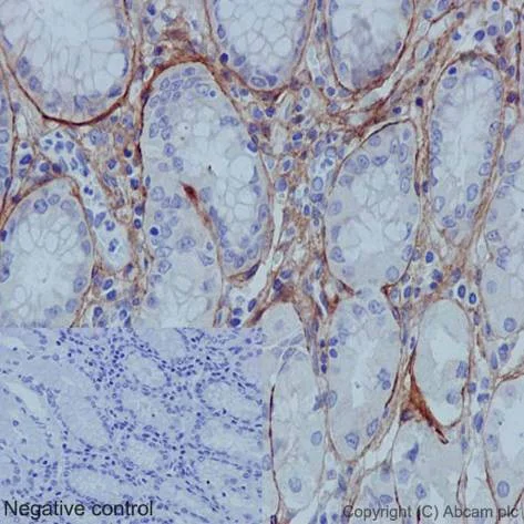Immunohistochemistry (Formalin/PFA-fixed paraffin-embedded sections) - Anti-Collagen I antibody [EPR7785] - BSA and Azide free (AB215969)