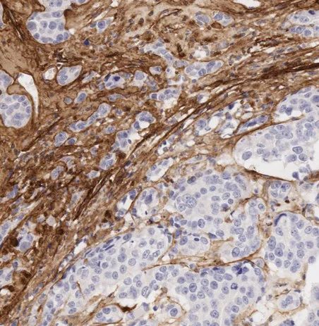 Immunohistochemistry (Formalin/PFA-fixed paraffin-embedded sections) - Anti-Collagen I antibody [EPR7785] - BSA and Azide free (AB215969)