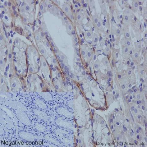 Immunohistochemistry (Formalin/PFA-fixed paraffin-embedded sections) - Anti-Collagen I antibody [EPR7785] - BSA and Azide free (AB215969)