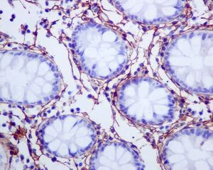 Immunohistochemistry (Formalin/PFA-fixed paraffin-embedded sections) - Anti-Collagen I antibody [EPR7785] - BSA and Azide free (AB215969)