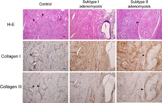 Anti-Collagen I antibody [EPR7785] - Carrier free (ab215969) | Abcam