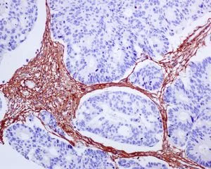 Immunohistochemistry (Formalin/PFA-fixed paraffin-embedded sections) - Anti-Collagen I antibody [EPR7785] - BSA and Azide free (AB215969)