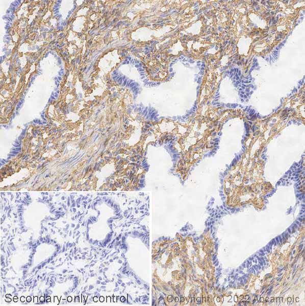 Immunohistochemistry (Frozen sections) - Anti-Collagen I antibody [EPR7785] - BSA and Azide free (AB215969)