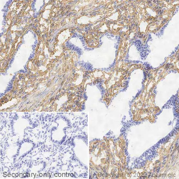 Immunohistochemistry (Frozen sections) - Anti-Collagen I antibody [EPR7785] - BSA and Azide free (AB215969)