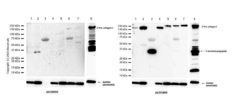 Western blot - Anti-Collagen I antibody [EPR7785] - BSA and Azide free (AB215969)
