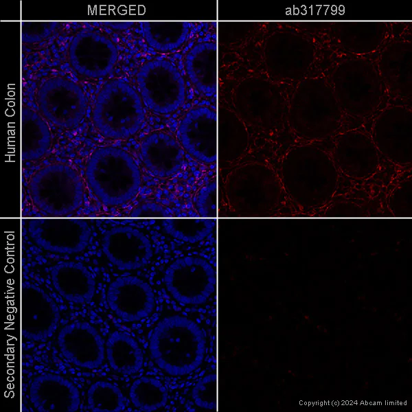 Immunohistochemistry (Formalin/PFA-fixed paraffin-embedded sections) - Anti-Collagen I antibody [EPR7785] – Mouse IgG1 (Chimeric) – BSA and Azide Free (AB317799)