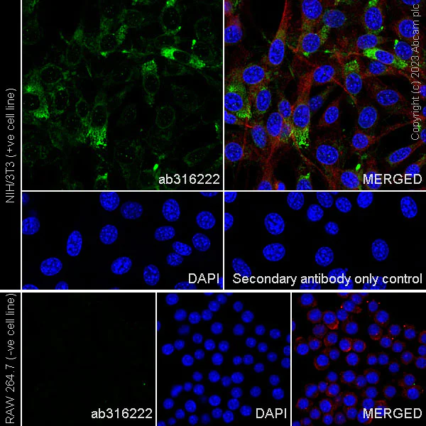 Immunocytochemistry/ Immunofluorescence - Anti-Collagen I antibody [RM1131] (AB316222)