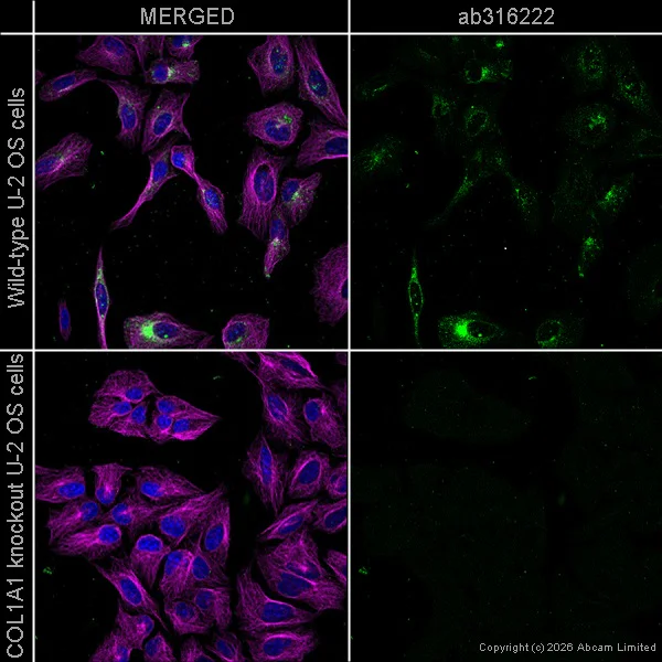 Immunocytochemistry/ Immunofluorescence - Anti-Collagen I antibody [RM1131] (AB316222)