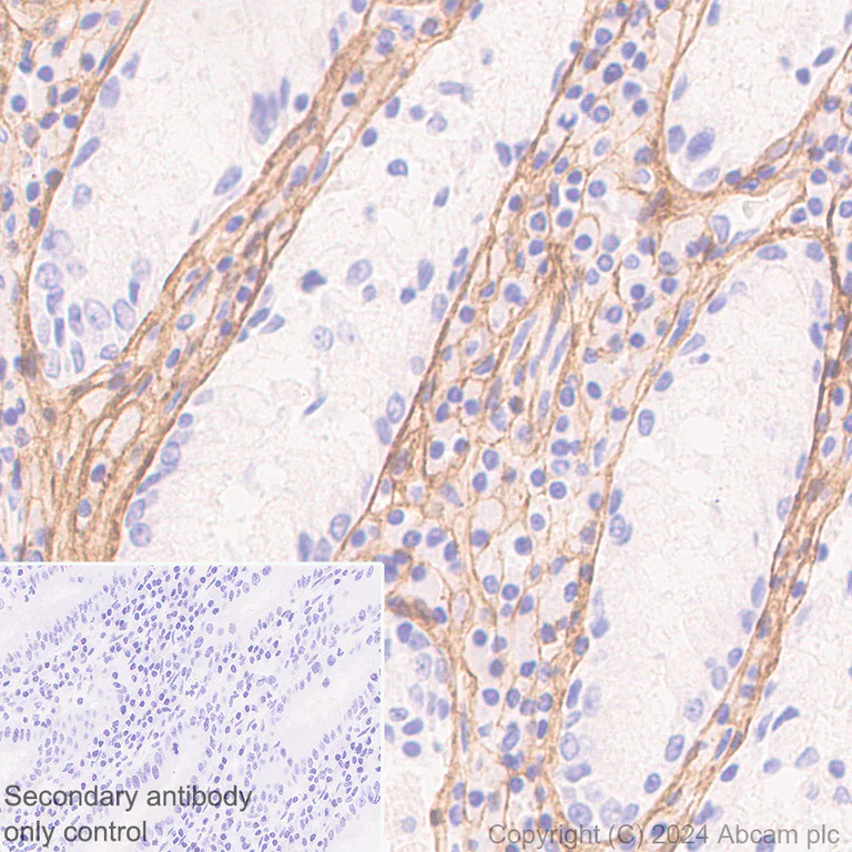 Immunohistochemistry (Formalin/PFA-fixed paraffin-embedded sections) - Anti-Collagen I antibody [RM1131] (AB316222)
