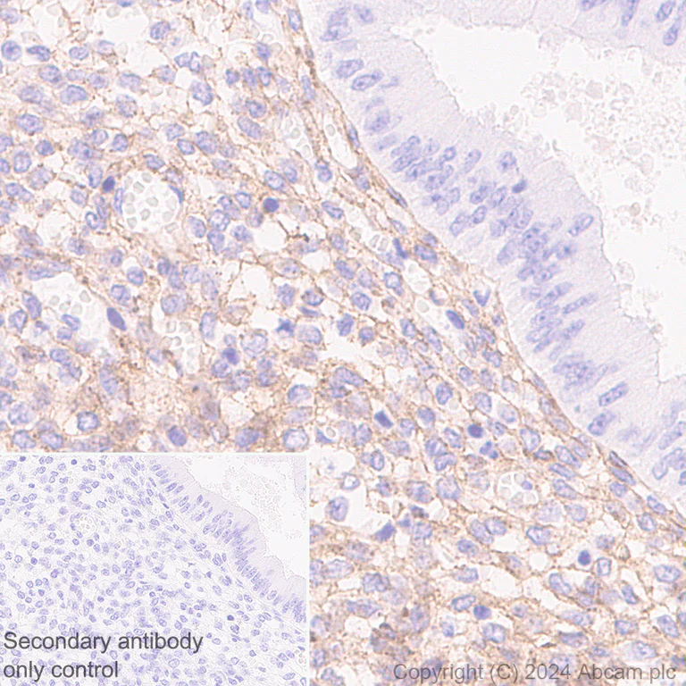 Immunohistochemistry (Formalin/PFA-fixed paraffin-embedded sections) - Anti-Collagen I antibody [RM1131] (AB316222)