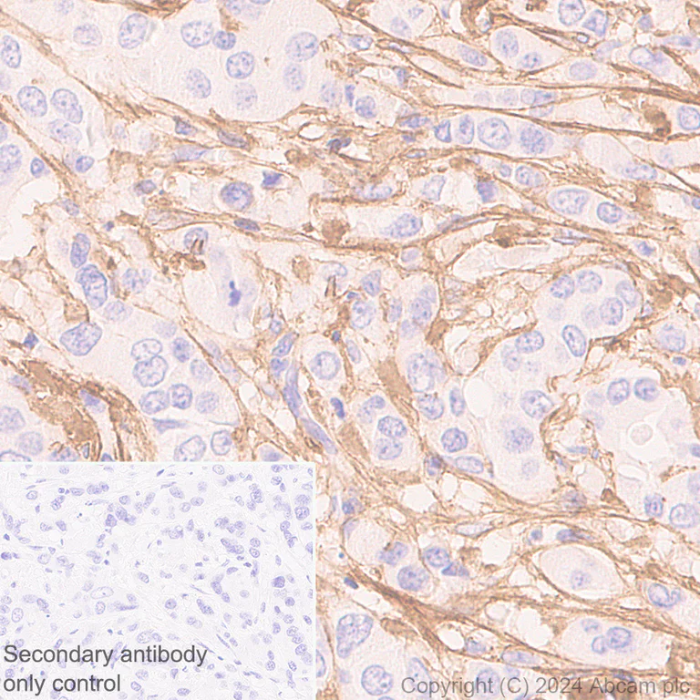Immunohistochemistry (Formalin/PFA-fixed paraffin-embedded sections) - Anti-Collagen I antibody [RM1131] (AB316222)