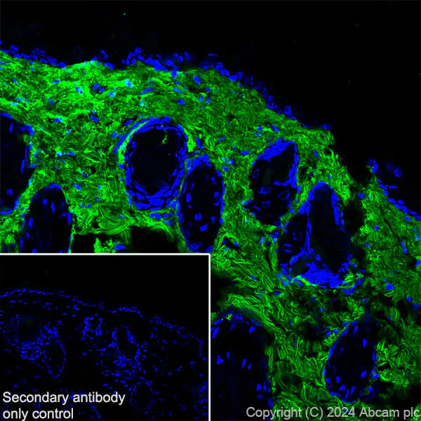 Immunohistochemistry (Frozen sections) - Anti-Collagen I antibody [RM1131] (AB316222)