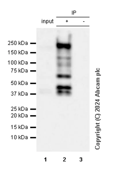 Immunoprecipitation - Anti-Collagen I antibody [RM1131] (AB316222)
