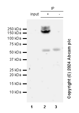 Immunoprecipitation - Anti-Collagen I antibody [RM1131] (AB316222)