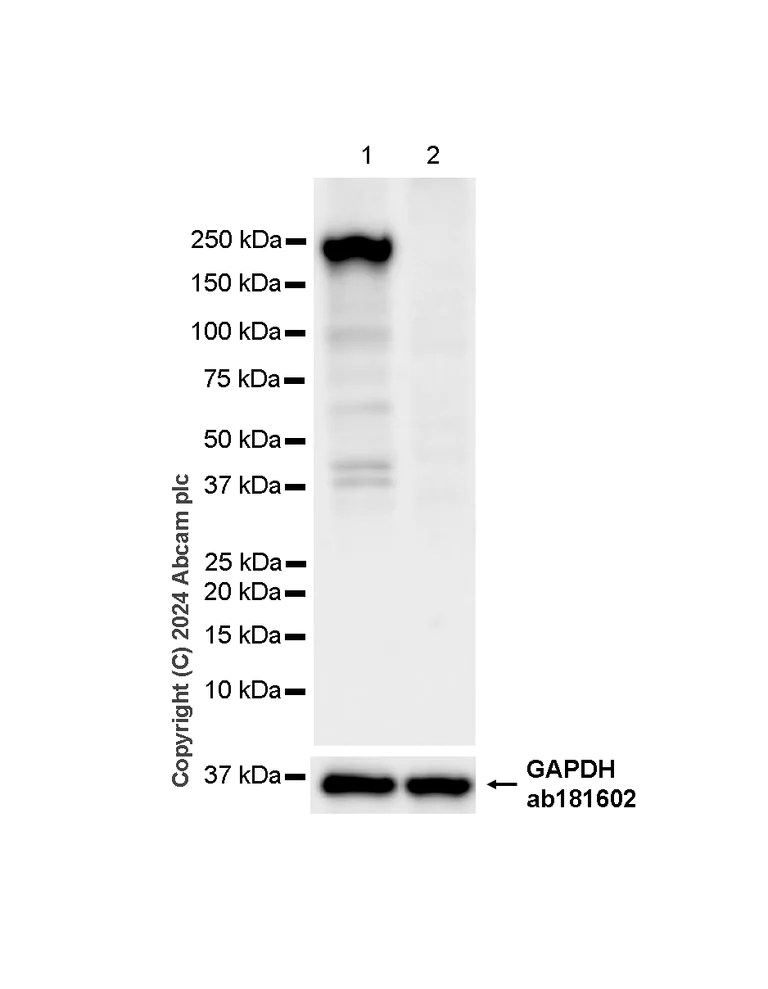 Western blot - Anti-Collagen I antibody [RM1131] (AB316222)