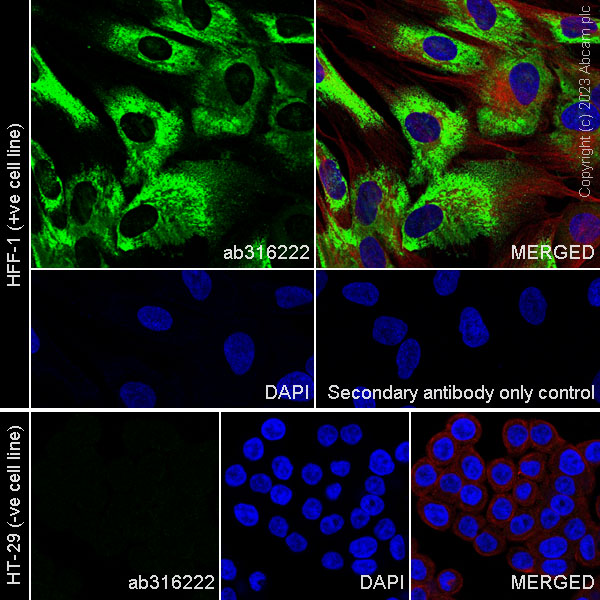 Immunocytochemistry/ Immunofluorescence - Anti-Collagen I antibody [RM1131] - BSA and Azide free (ab316223), expandable thumbnail