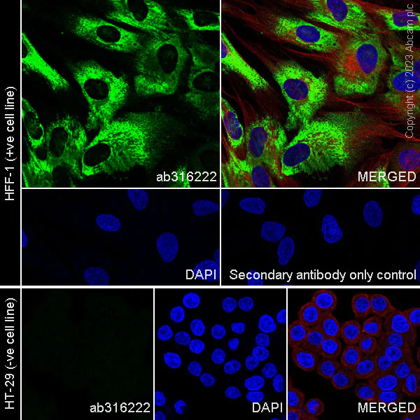 Immunocytochemistry/ Immunofluorescence - Anti-Collagen I antibody [RM1131] - BSA and Azide free (AB316223)