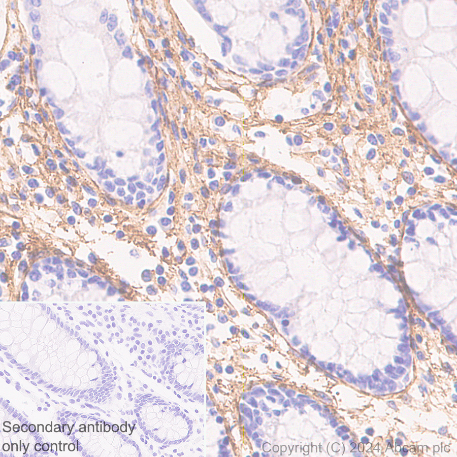 Immunohistochemistry (Formalin/PFA-fixed paraffin-embedded sections) - Anti-Collagen I antibody [RM1131] - BSA and Azide free (ab316223), expandable thumbnail