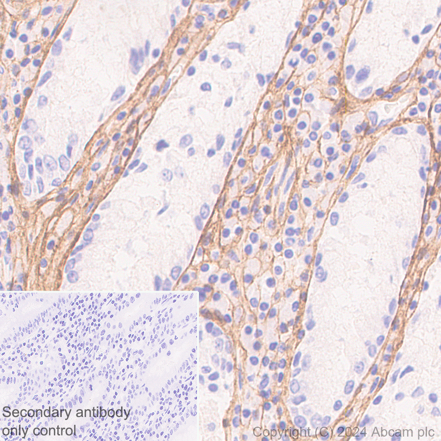 Immunohistochemistry (Formalin/PFA-fixed paraffin-embedded sections) - Anti-Collagen I antibody [RM1131] - BSA and Azide free (ab316223), expandable thumbnail