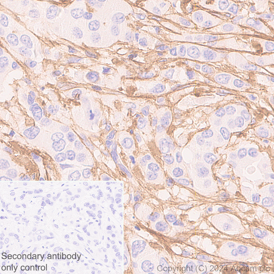 Immunohistochemistry (Formalin/PFA-fixed paraffin-embedded sections) - Anti-Collagen I antibody [RM1131] - BSA and Azide free (ab316223), expandable thumbnail