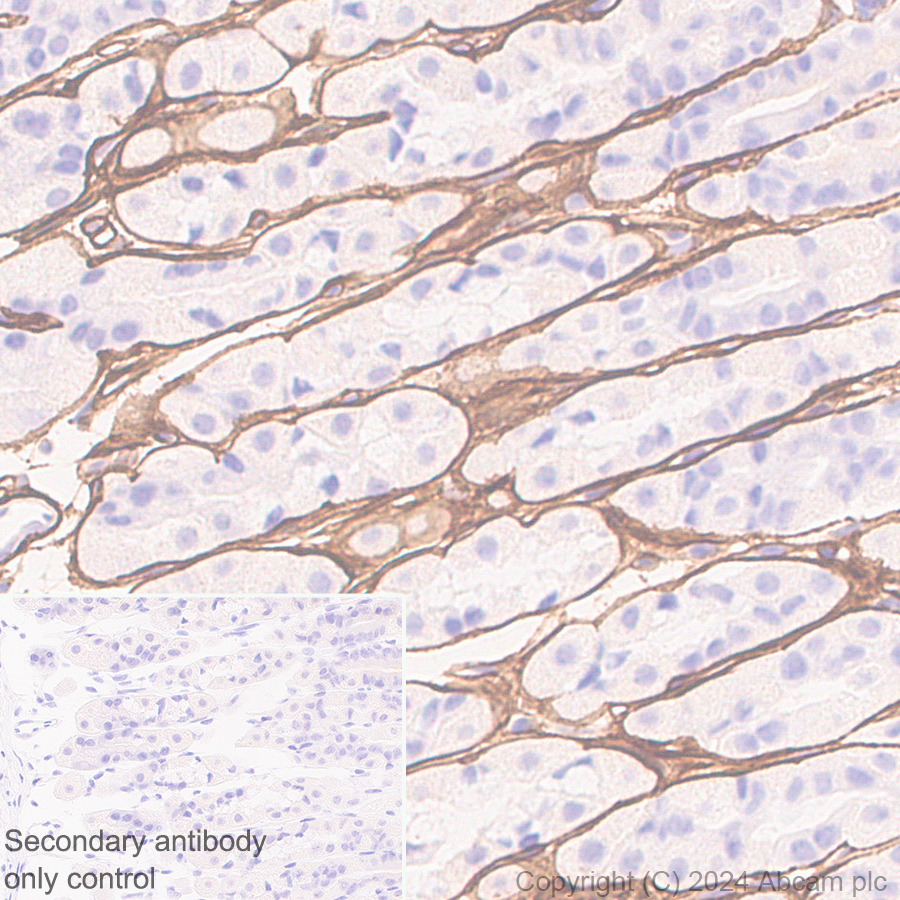 Immunohistochemistry (Formalin/PFA-fixed paraffin-embedded sections) - Anti-Collagen I antibody [RM1131] - BSA and Azide free (ab316223), expandable thumbnail