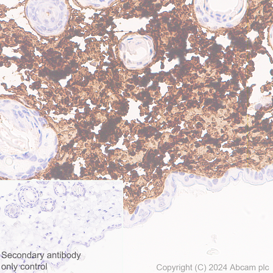 Immunohistochemistry (Formalin/PFA-fixed paraffin-embedded sections) - Anti-Collagen I antibody [RM1131] - BSA and Azide free (ab316223), expandable thumbnail