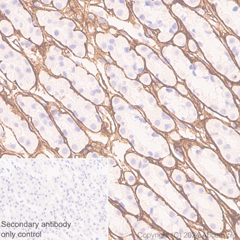 Immunohistochemistry (Formalin/PFA-fixed paraffin-embedded sections) - Anti-Collagen I antibody [RM1131] - BSA and Azide free (AB316223)