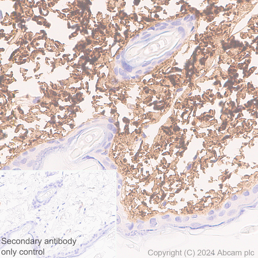 Immunohistochemistry (Formalin/PFA-fixed paraffin-embedded sections) - Anti-Collagen I antibody [RM1131] - BSA and Azide free (ab316223), expandable thumbnail