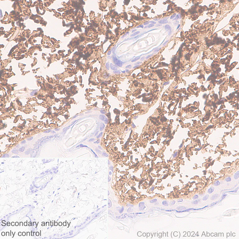 Immunohistochemistry (Formalin/PFA-fixed paraffin-embedded sections) - Anti-Collagen I antibody [RM1131] - BSA and Azide free (AB316223)