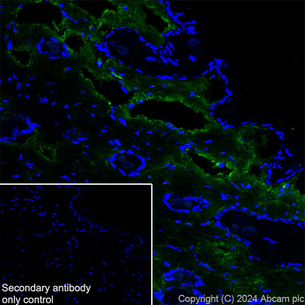 Immunohistochemistry (Frozen sections) - Anti-Collagen I antibody [RM1131] - BSA and Azide free (ab316223), expandable thumbnail