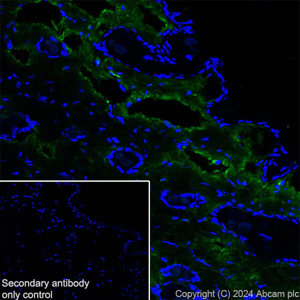 Immunohistochemistry (Frozen sections) - Anti-Collagen I antibody [RM1131] - BSA and Azide free (AB316223)