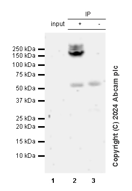 Immunoprecipitation - Anti-Collagen I antibody [RM1131] - BSA and Azide free (ab316223), expandable thumbnail