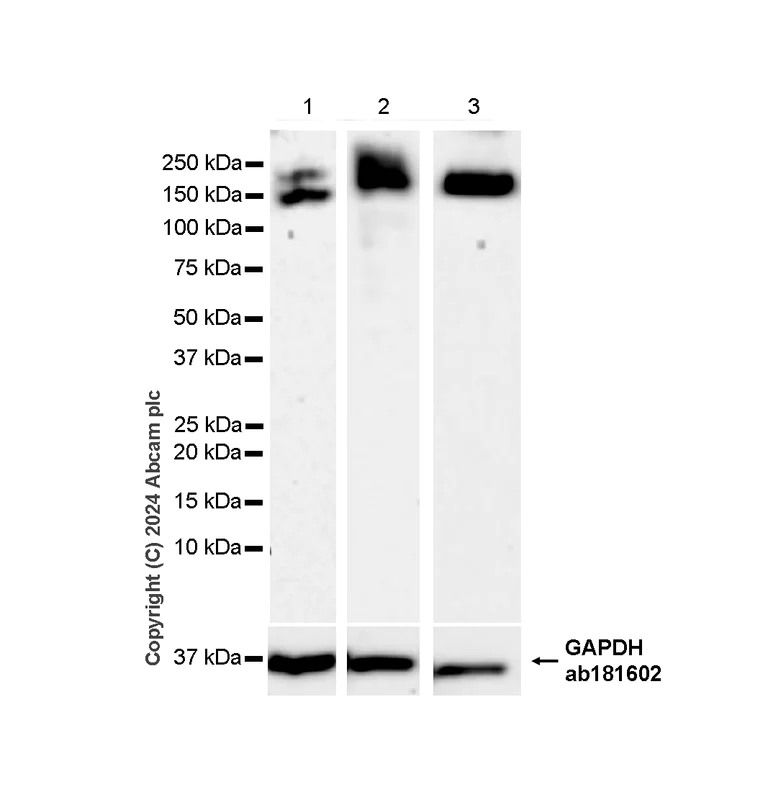 Western blot - Anti-Collagen I antibody [RM1131] - BSA and Azide free (AB316223)