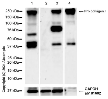 Western blot - Anti-Collagen I antibody [RM1131] - BSA and Azide free (AB316223)