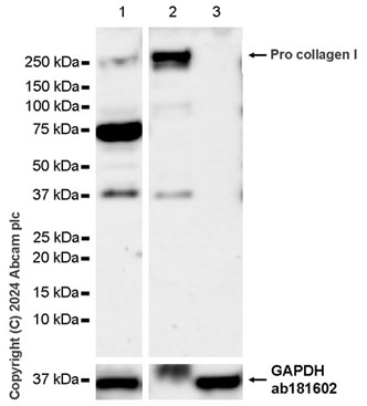 Western blot - Anti-Collagen I antibody [RM1131] - BSA and Azide free (AB316223), expandable thumbnail