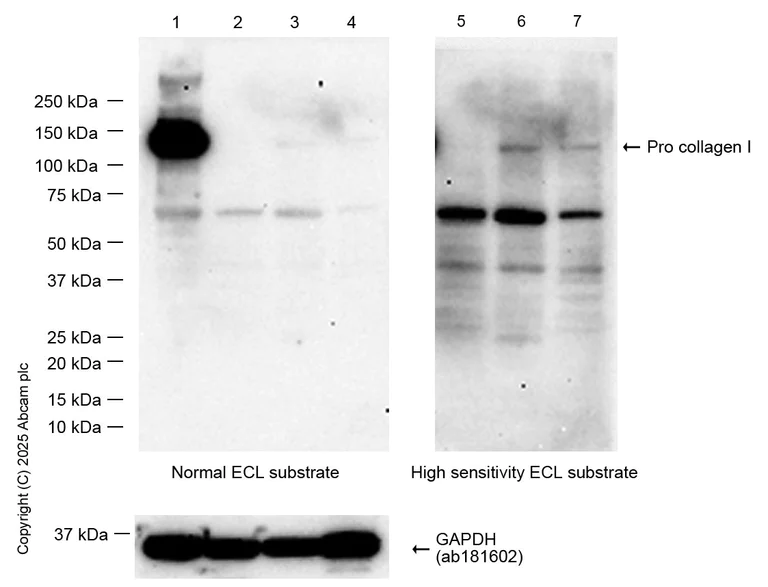 Western blot - Anti-Collagen I antibody [RM1131] - BSA and Azide free (AB316223)