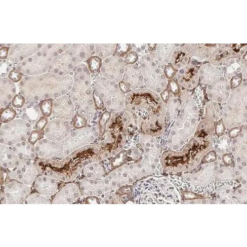 Immunohistochemistry (Formalin/PFA-fixed paraffin-embedded sections) - Anti-Collagen I + Collagen II + Collagen III antibody [HL2048 + HL1907] (AB317539)