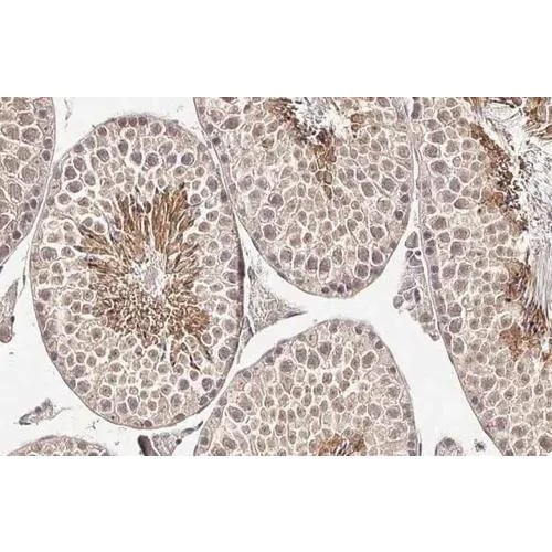 Immunohistochemistry (Formalin/PFA-fixed paraffin-embedded sections) - Anti-Collagen I + Collagen II + Collagen III antibody [HL2048 + HL1907] (AB317539)