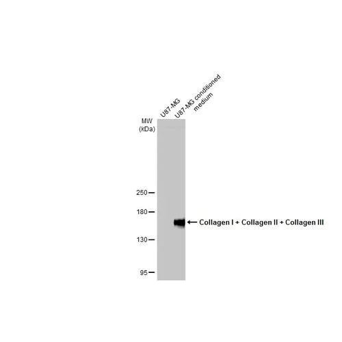 Western blot - Anti-Collagen I + Collagen II + Collagen III antibody [HL2048 + HL1907] (AB317539)