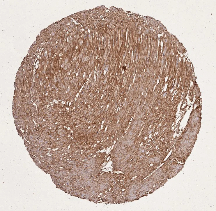 Immunohistochemistry (Formalin/PFA-fixed paraffin-embedded sections) - Anti-Collagen I + Collagen III antibody (AB34710)