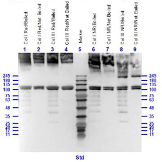 Western blot - Anti-Collagen I + Collagen III antibody (AB34710)