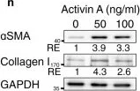 Western blot - Anti-Collagen I + Collagen III antibody (AB34710)