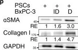 Western blot - Anti-Collagen I + Collagen III antibody (AB34710)