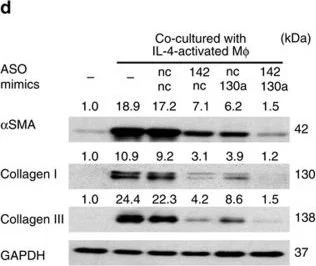 Western blot - Anti-Collagen I + Collagen III antibody (AB34710)