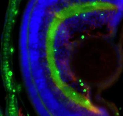 IHC - Wholemount - Anti-Collagen II antibody (AB209865)
