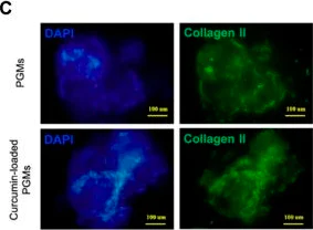 Immunocytochemistry/ Immunofluorescence - Anti-Collagen II antibody (AB34712)